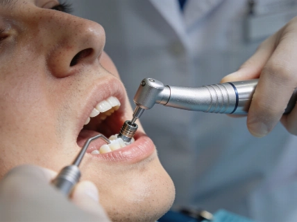 Preventing Implant Disease Starts Before Surgery The Young Dentist