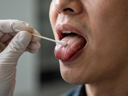 Tongue Bacteria Track With Cognitive Test Scores The Young Dentist
