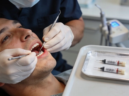 PRF Plus Minocycline Ties Arestin at Six Months The Young Dentist