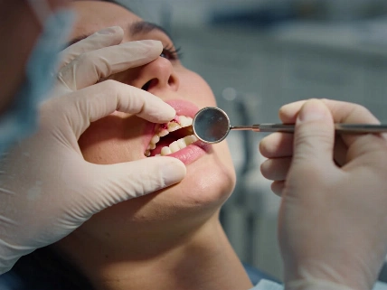 Pharmacy Records Reframed a Gum Lesion The Young Dentist