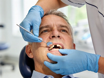 Bone loss diagnosis changes the plan for diastema treatment The Young Dentist